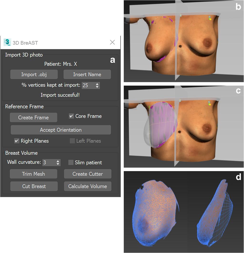Eur J Plast Surg (2018) 41:663 670 669 Fig. 6 User interface and steps to use the 3D BreAST. a The user interface.