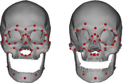 Skull Reconstruction Flip Avoidance Use manually marked landmarks to ensure anatomical