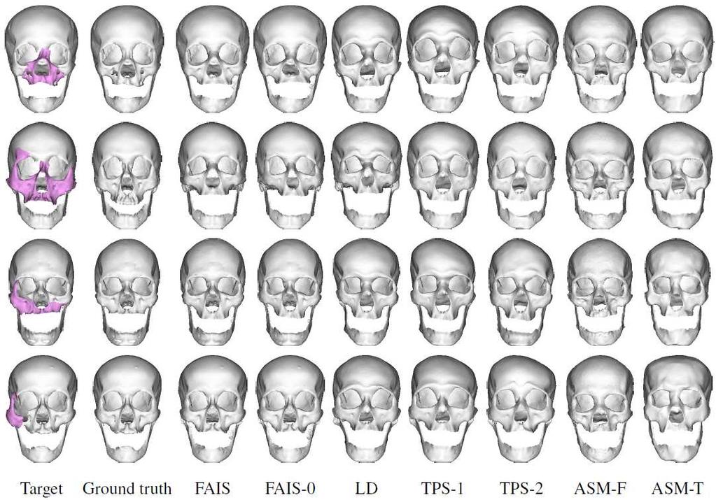 Skull Reconstruction Test Results Test on synthetic defective