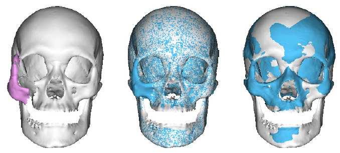 Skull Reconstruction Test Results Comparison of FAIS and ASM results.