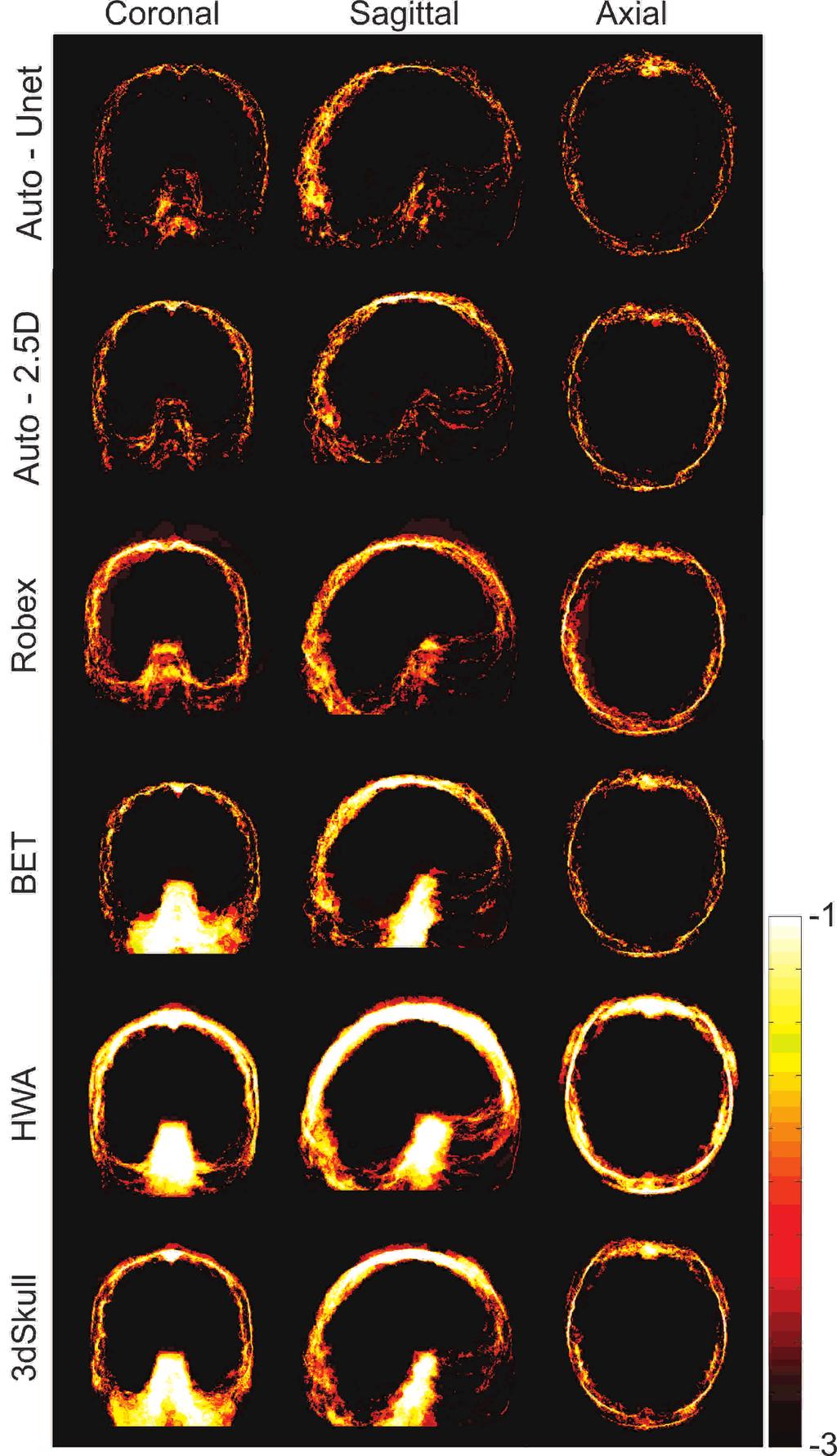 10 Figure 6. Logarithmic-scale absolute error maps of brain extraction obtained from six algorithms on the LPBA40 dataset.