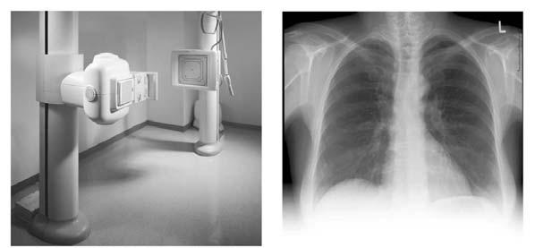 Image Science Introduction Medical Imaging Modalities Ho Kyung Kim hokyung@pusan.ac.