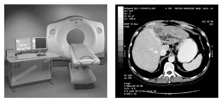 axis CT MRI PET Why do the images