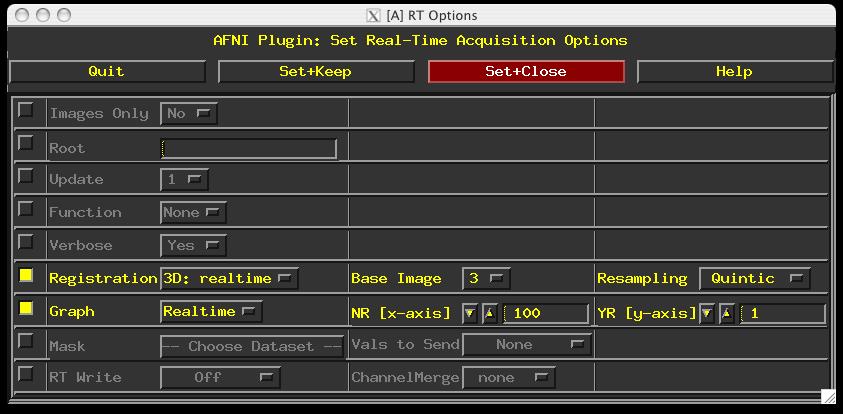 Setting up AFNI's RT plugin Via Environment Variables setenv
