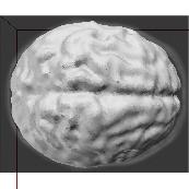 280 H.P. Ho k=20, F =F 1 k=20, F =F 2 k=12, F =F 2 Fig. 1. Brain segmentations using same set of sampling point cloud with different forces in Eqn. (2) and samples per influence domain (k).