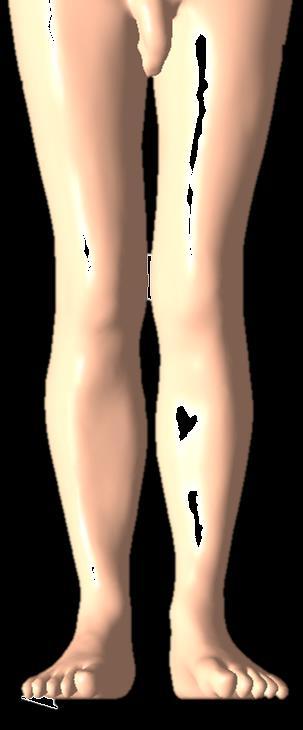 the scaling factor for leg length (= the