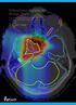 Robustness Recipes for Proton Therapy