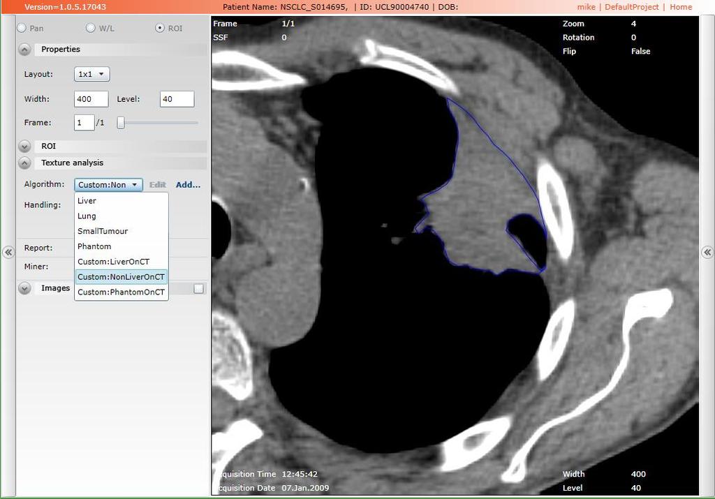 4.5.3 Custom: Liver_CT This algorithm includes only pixels between 0 and 300 HU within ROI using "threshold" as padding (erosion-scale=0) for reducing edge artefacts in the case of large organ such