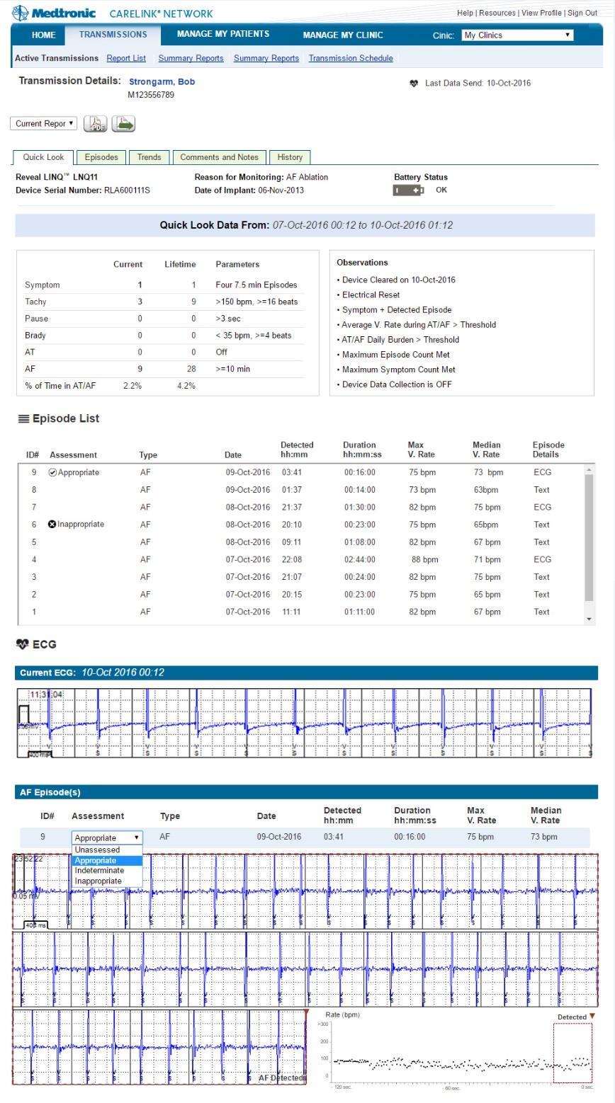 Scroll to selected ID# to view the Episode ECG/Plot. 6. Choose an ASSESSMENT from the dropdown box. 4 NOTE: ASSESS EPISODES EACH TIME YOU ARE IN QUICK LOOK.