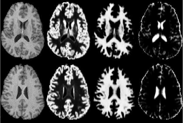 Brain MR, Segmentation result 24/35