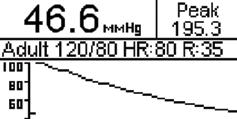 75 mv; ± 2% @ Lead II 24 Composite Pressure Display Output Pressure Display (NOTE: The output Waveform is NOT Physiologically Correct.