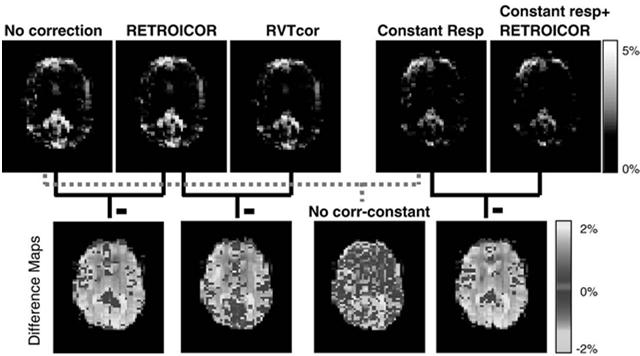 , Brain parenchyma motion: measurement with cine echo-planar MR imaging. Radiology 185:645-651 (1992).