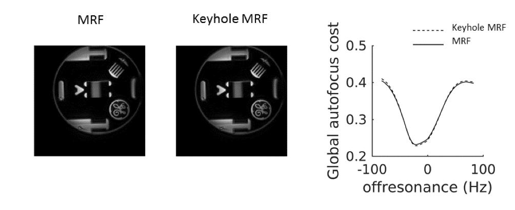 6 Buonincontri et al. Fig. 5. Average of MRF and Keyhole MRF frames on a resolution phantom. The images have a similar level of detail.