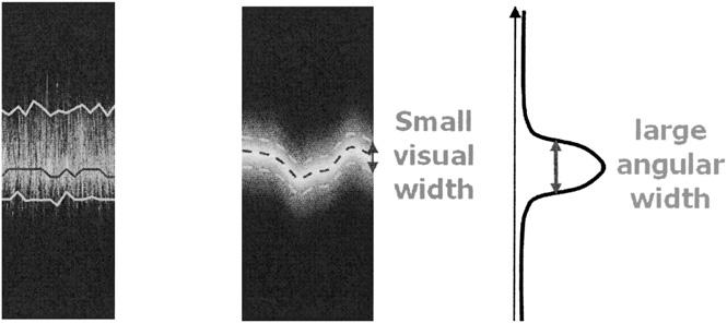2008 TRI/PRINCETON CONFERENCE 165 Figure 13. On very dark hair that is not perfectly combed, the visual width can be signifi cantly narrower than the width measured on the profi les.