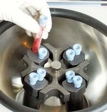 The advantage of this system is that we can add additional rotors to the range without changing the centrifuge model.