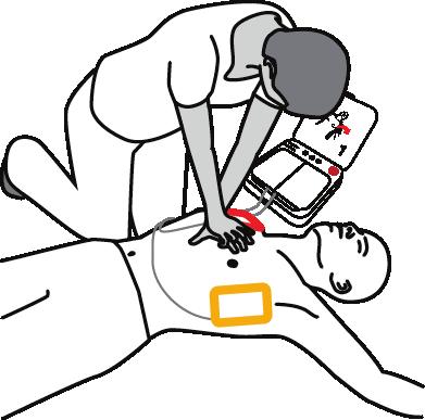 The defibrillator will automatically deliver a shock without requiring further action.