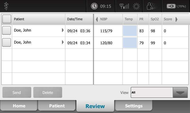 Reviewing Vital Signs Multi-Patient View The Review tab displays patient data that has been previously captured. Data can be viewed for a single patient or for multiple patients.