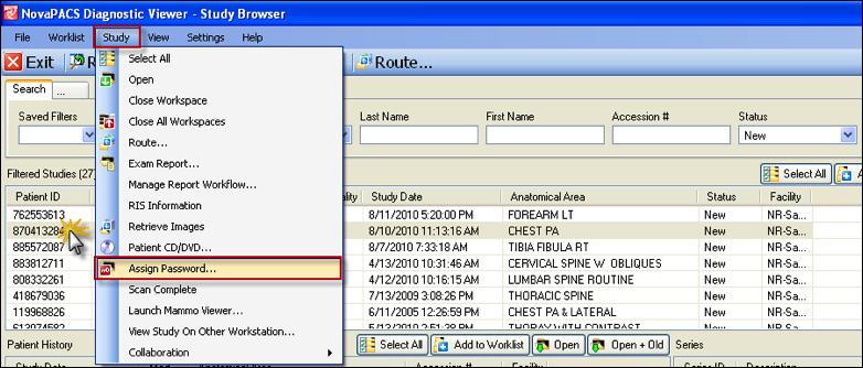 Web based pacs viewer The password will need to be assigned by an employee who has access to the study browser.