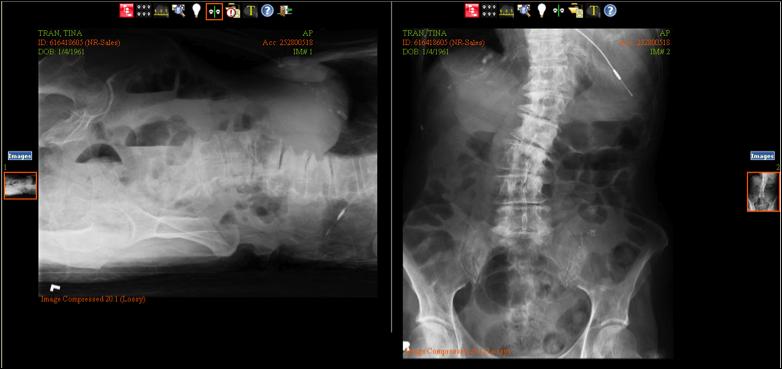 Web Based pacs viewer The user will be able to view the patient s images in the Lite Viewer.