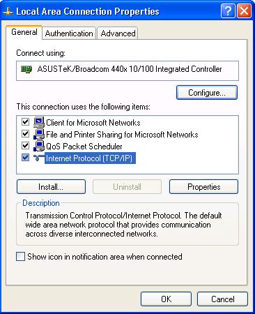 In the LAN Area Connection Status window, click