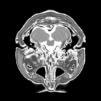 1 MRI (magnetic resonance imaging) MRI is a