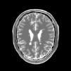 MRI systems produce brain images in