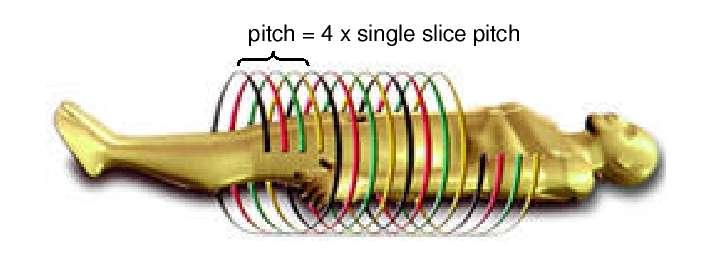 thickness the table moves during one rotation (typically ~1-2) Multi-slice spiral