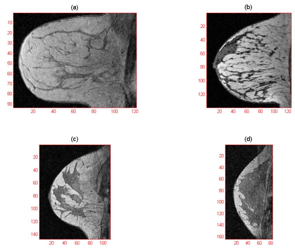 Wang et al. Page 14 Fig. 3. The central slice of T 1 -w images from dataset 1 4 is displayed in (a) (d) respectively.