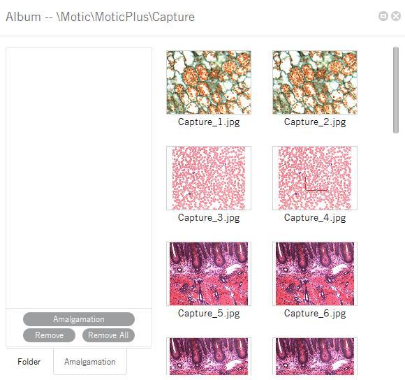 Menus and tools / File / Album / Amalgamation Amalgamation is a helpful tool for image overlay, especially for multiple stained samples in fluorescence.