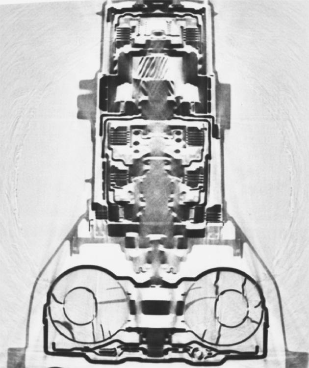 Planar X-Ray Computed