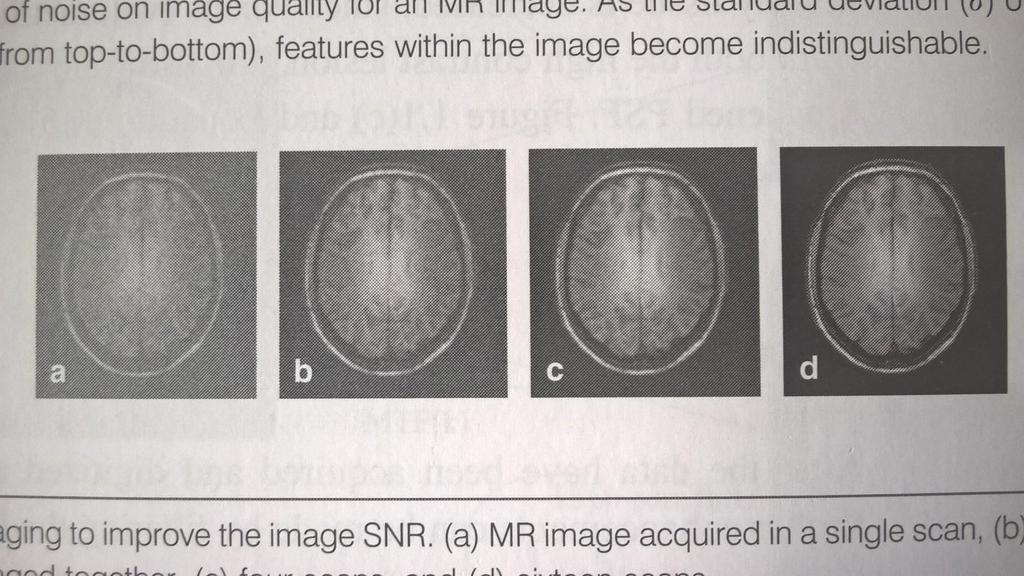 Example of averaging the signal: MRI scan Taken from Ref. 1 pg. 11 a. One scan b.