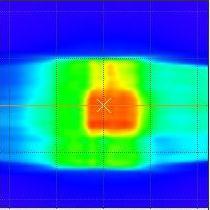 8. Detector array dosimetry audit methodology Predicted dose 2D array Gafchromic film Figure 8.