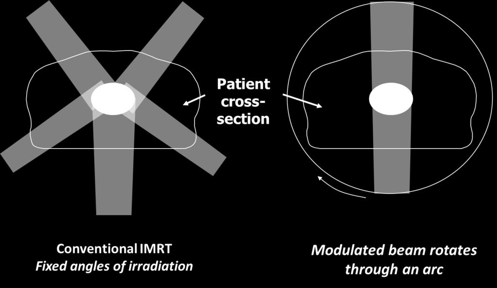 3 Schematic showing difference between static IMRT (left) and rotational IMRT (right). 1.3.1 Tomotherapy In Tomotherapy [7], the linear accelerator head is mounted in a CT scanner style gantry.