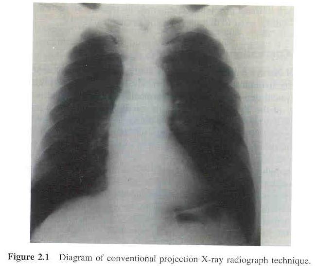 Conventional Radiography:Example ITCS 6010:Biomedical