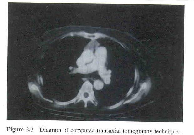 X-Ray Computed Tomography (CT) ITCS 6010:Biomedical