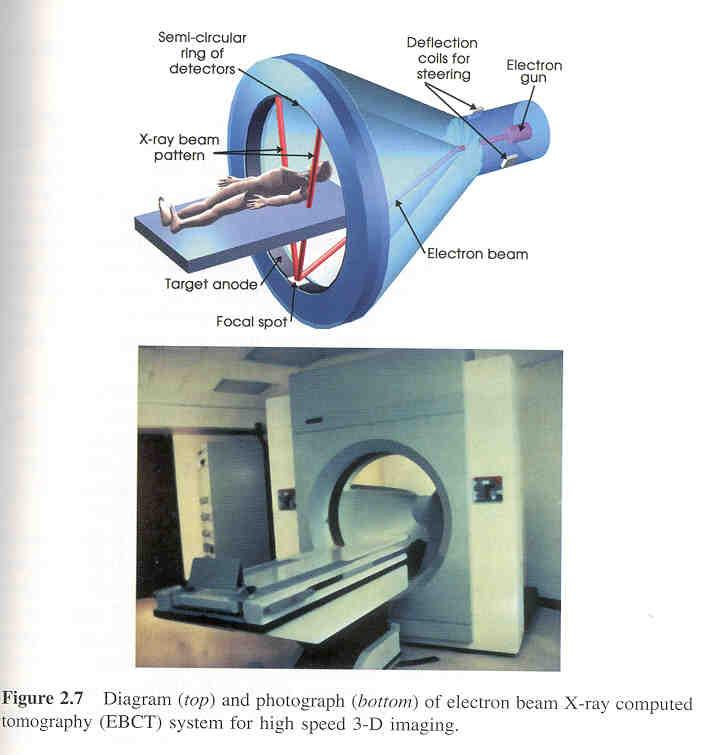 Electron-Beam CT ITCS 6010:Biomedical Imaging