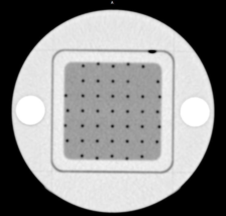 Figure 4. Axial CT scan of grid insert. Grid dimensions were measured along the long dimensions (60 mm) and diagonal (shown as dashed lines) in the central and peripheral sections of the grid. B.