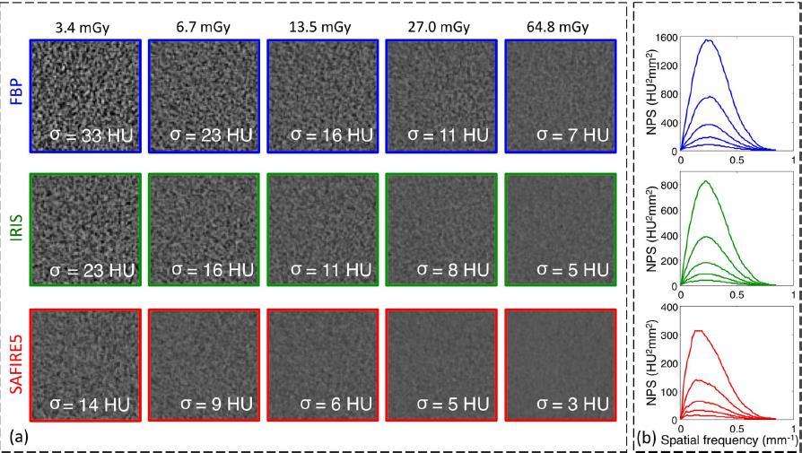 Noise Comparison between FBP and IR Chen et al, Assessing CT Noise and