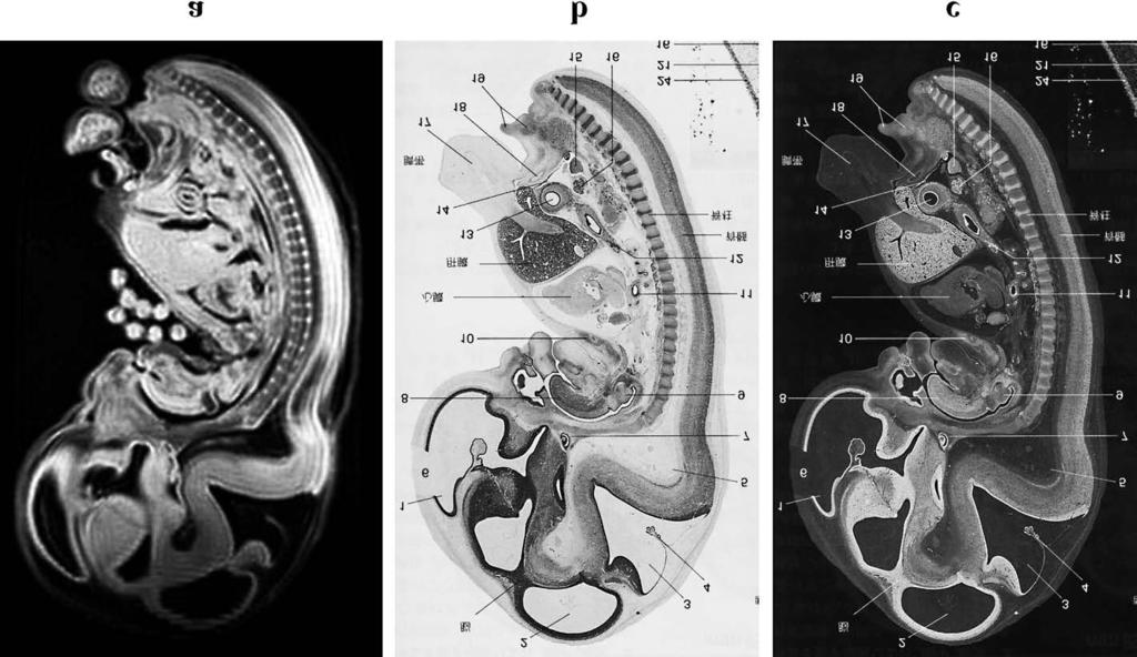 a: T 1 -weighted spin echo image (repetition time/echo time:100 ms/8 ms); b: anatomical section with Nissl staining; 11 c: inverted contrast image of b.
