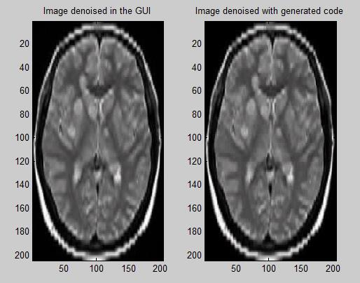 The De-noised second brain The Performance evaluation of de-noising can be observed in the tables 1 & 2.