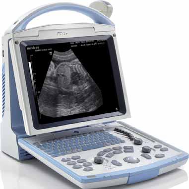 DP-20 exceeds your expectations Smart portable B/W ultrasound system with advanced features Display modes and imaging processing: Broadband, multi-frequency imaging: B, B/B, 4B, B/M, M Imaging