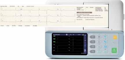 connection to PC - 12 leads grid printing on normal A4 paper by external printer ECG Viewer Software: PC based ECG data management software - compatible with Windows XP, WIN 7, Vista (32 bit, 64 bit)