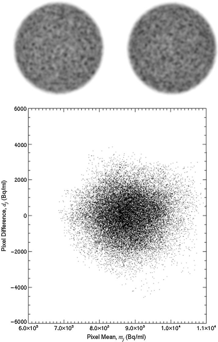 1072 M A Lodge et al Figure 1. Corresponding slices from two separately acquired images differ due to statistical noise.