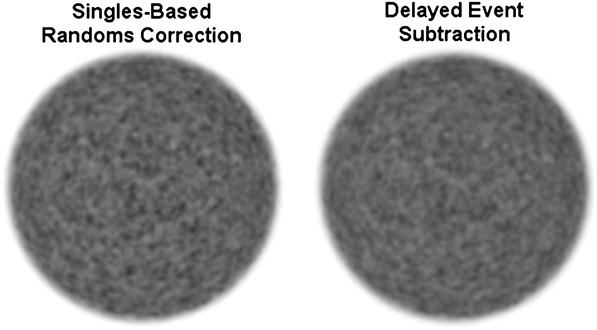 Measurement of noise and resolution in PET 1075 Figure 2. Images reconstructed from the same projection data using singles-based randoms correction (left) and delayed event subtraction (right).