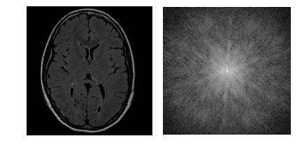 2.1 Magnetic Resonance Imaging 17 determines the field of view (FoV). The reconstruction from k-space to a spatial image is made through a 2D Fourier transform (Fig 2.12)