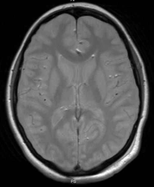 20 Conventional Contrast-Weighted Imaging that initially inverts the magnetization M 0.