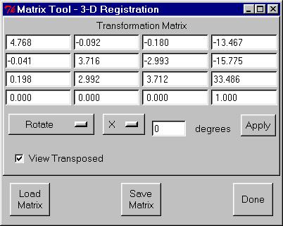 When registration is complete, the Matrix Tool window will appear with the registration transform for registering the SPECT volume images to the MRI volume image (Figure 33).