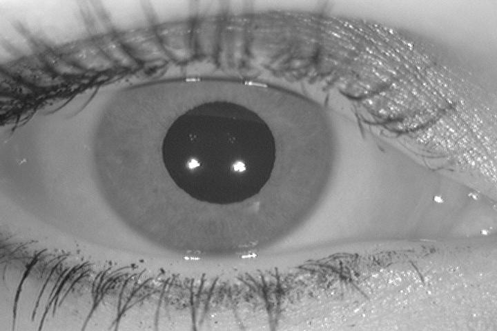 Common occlusions in non-ideal iris images include reflections, eyelids, eyelashes, eye aids, and any off-angles or off-axis tilts.