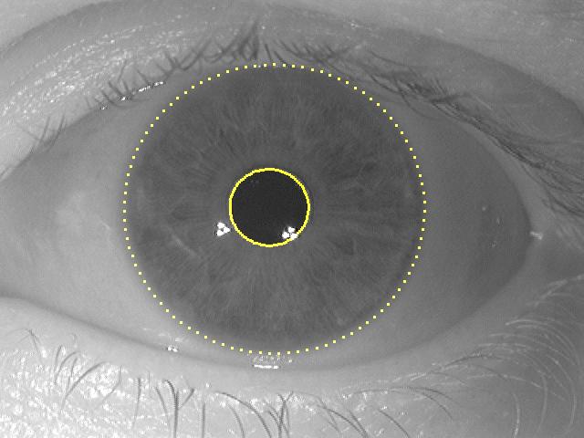 The proposed method has been tested on noisy iris images acquired from the WVU eye center. This dataset includes images captured at off-axis tilts and off-angles.