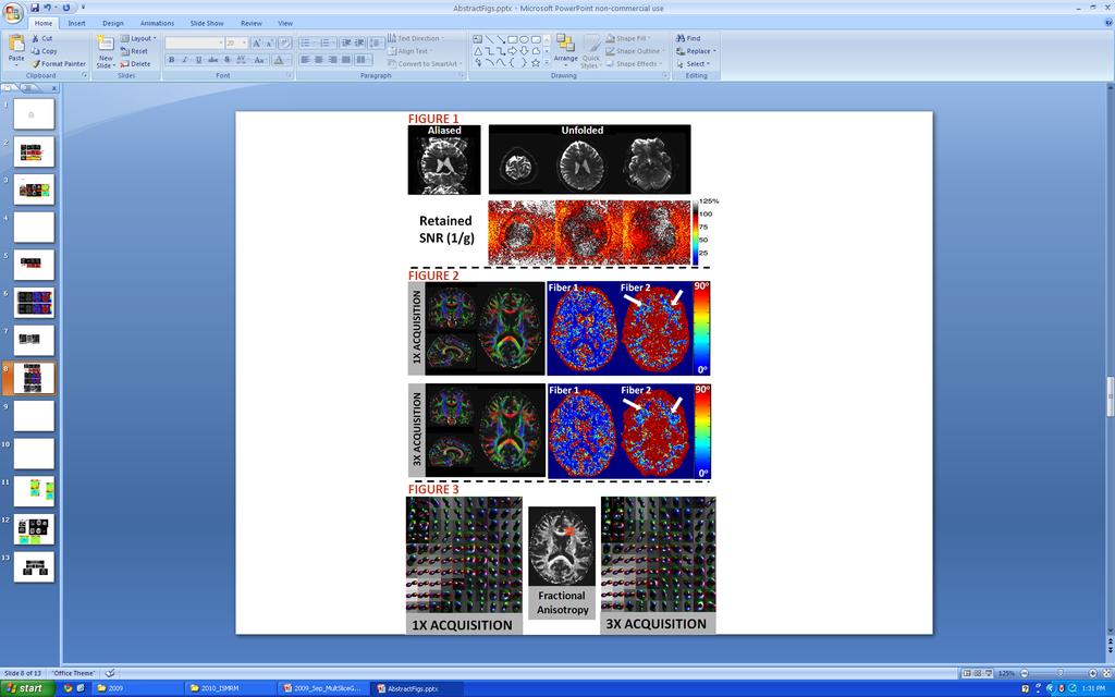 Simultaneous multi-slice dmri DTI (64 directions, b=1000 s/mm 2, 2 mm isotropic) Conventional acquisition: 10 min 3-fold SMS